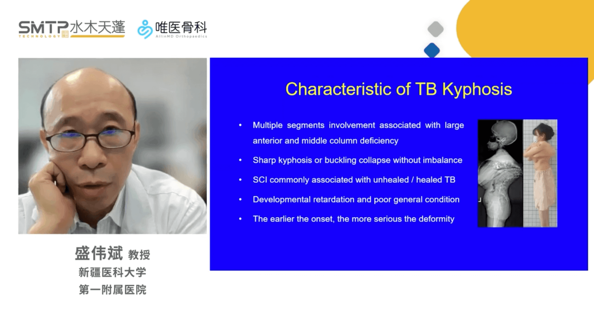 超声骨刀在结核性脊柱后凸畸形截骨矫形中的应用与技巧